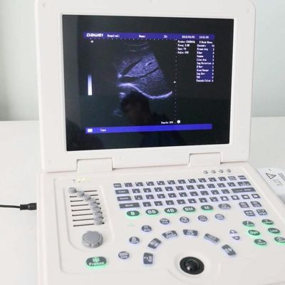 ποιότητας GYN Factory Supply Dw580 Portable Ultrasound Machine For Sale εργοστάσιο